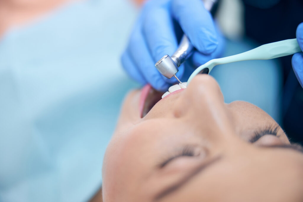 Dentist in blue gloves polishing a patient's front teeth with a dental handpiece and mirror during a check-up and clean